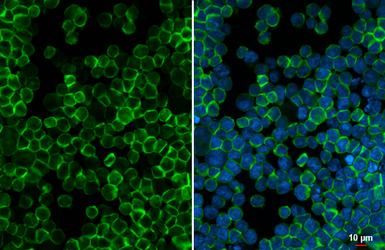 Anti-SHIP1 antibody [HL5681] used in Immunocytochemistry/ Immunofluorescence (ICC/IF). GTX646490